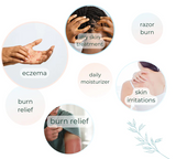 Eczema Gel